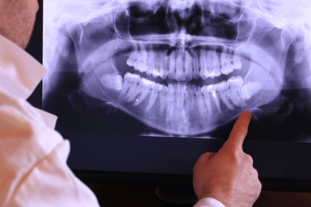 Best Same-Day Emergency Dental Services in Hybla Lley, VA