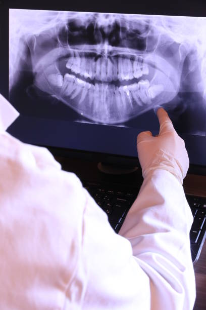 Best Emergency Root Canal Treatment in Hybla Lley, VA