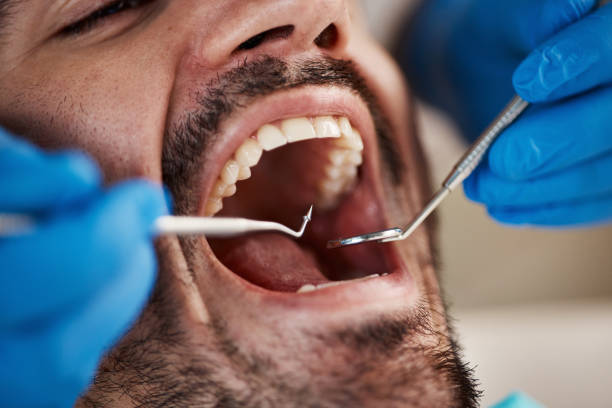 Best Same-Day Emergency Dental Services in Hybla Lley, VA