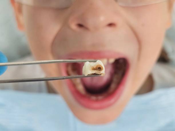Best Same-Day Emergency Dental Services in Hybla Lley, VA