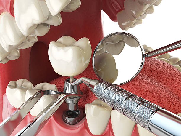 Best Emergency Denture Repair in Hybla Lley, VA