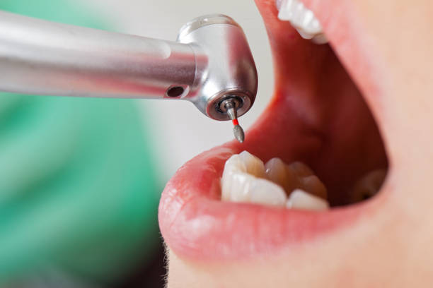 Best After-Hours Dental Trauma Care in Hybla Lley, VA
